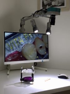 ingranditore digitale odontoiatria