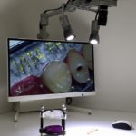 ingranditore digitale odontoiatria